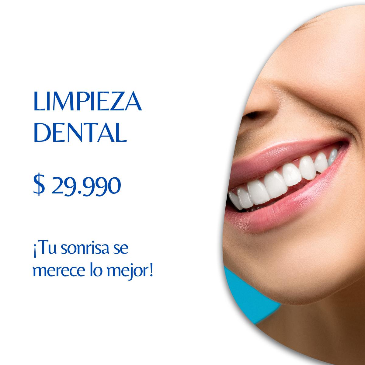 Limpieza Dental